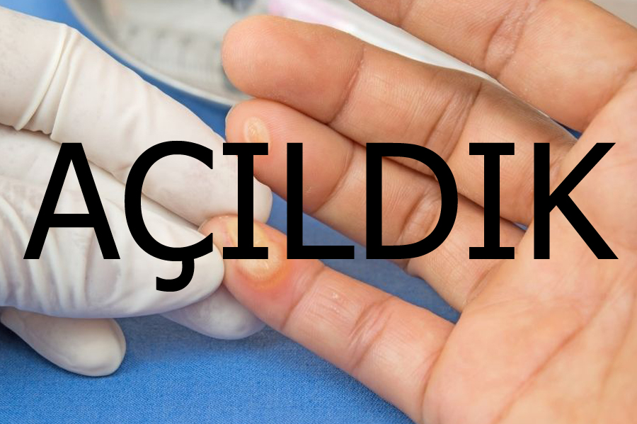 AÇILDIK