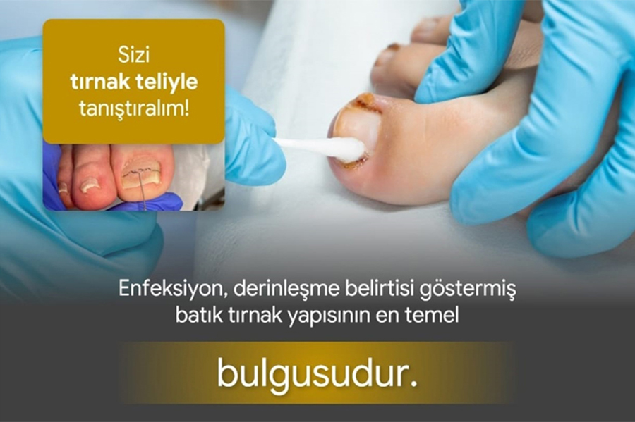DİĞER